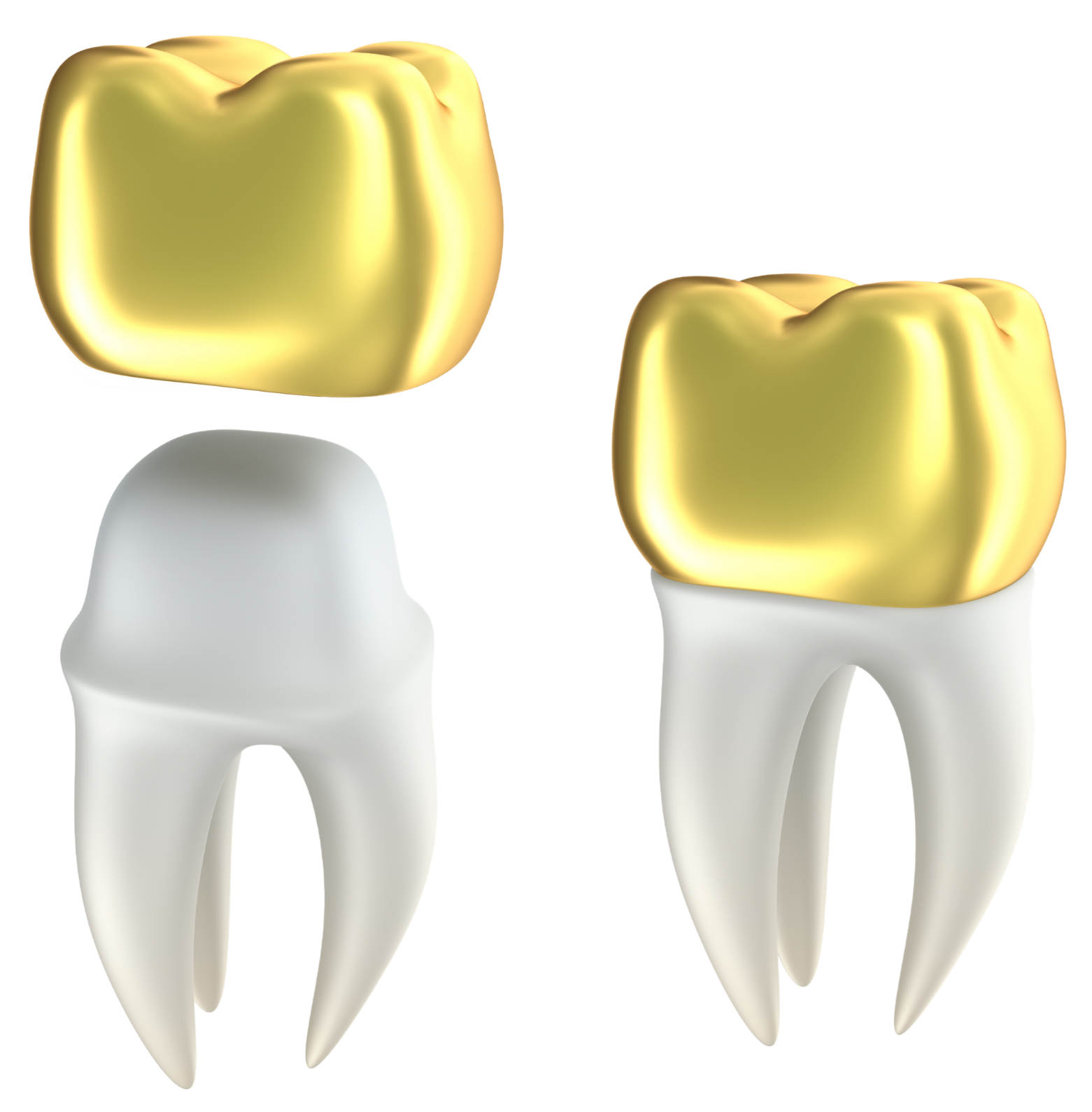 Dental Crowns North York