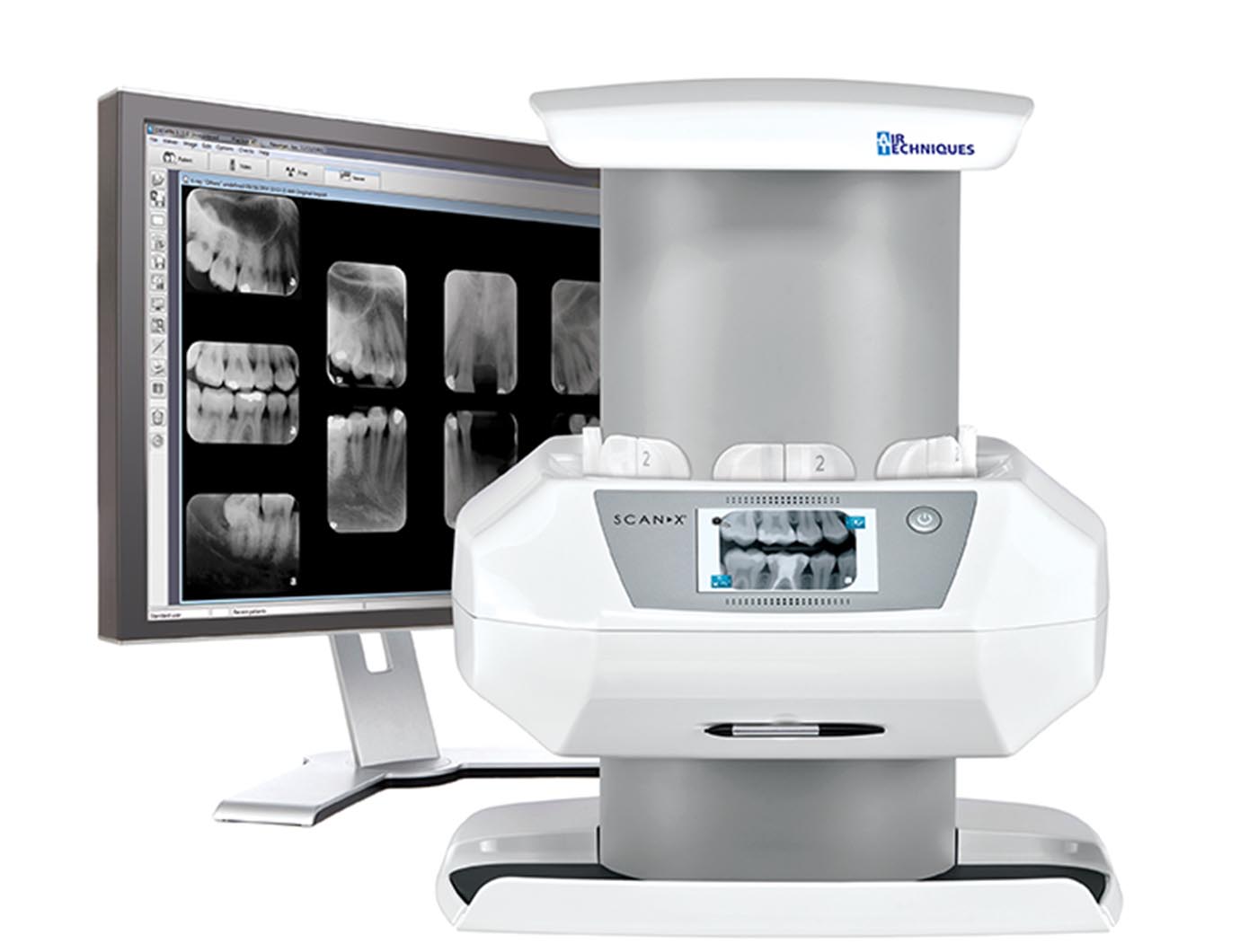 Digital Intra Oral Xray ScanX North York